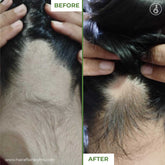 Medicated Hair Loss Treatment 50ml